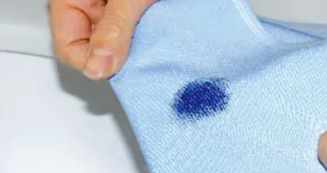 How to remove blue stain from white clothes