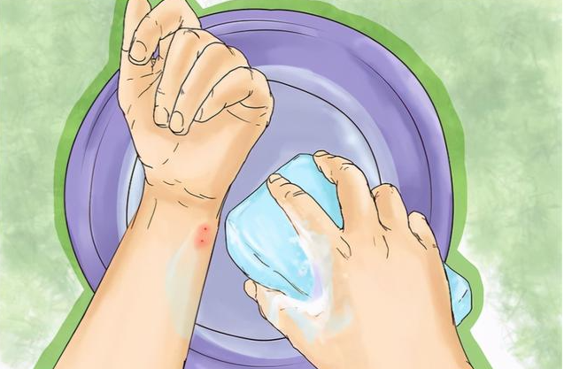 Can soap clean wounds at home
